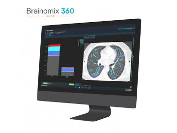 Boehringer backs Brainomix AI software for lung fibrosis