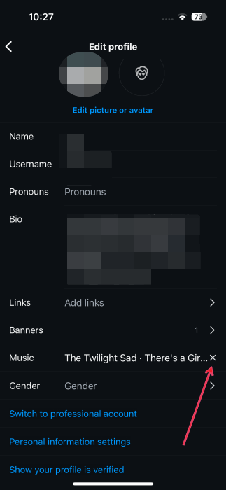 Deleting profile music from the Edit profile screen on Instagram app on iPhone.